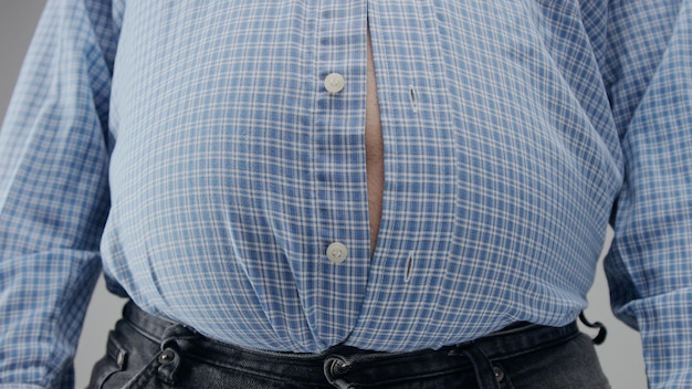 L'uomo in sovrappeso in shrt è piccolo per lui con la pancia enorme e i bottoni aperti