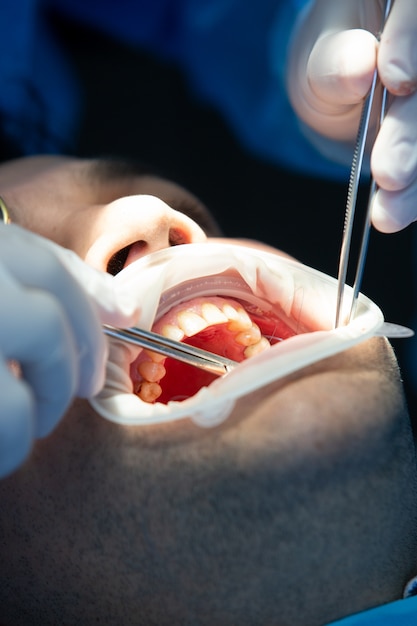 手術中の歯科医院の患者