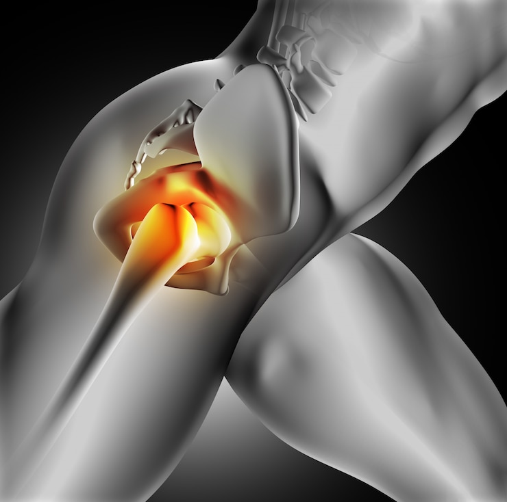 Free Photo pain in the hip joint