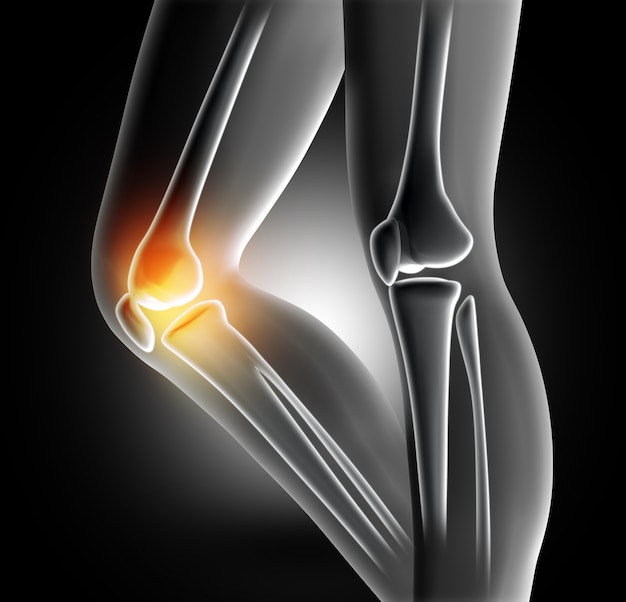 Free photo pain in the knee joint