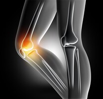 Free photo pain in the knee joint