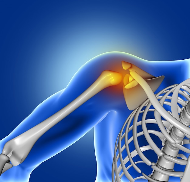 Pain of shoulder joint