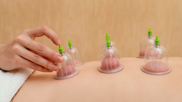 Patient experiencing cupping therapy
