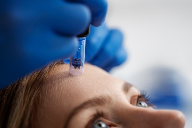 Patient undergoing microneedling procedure