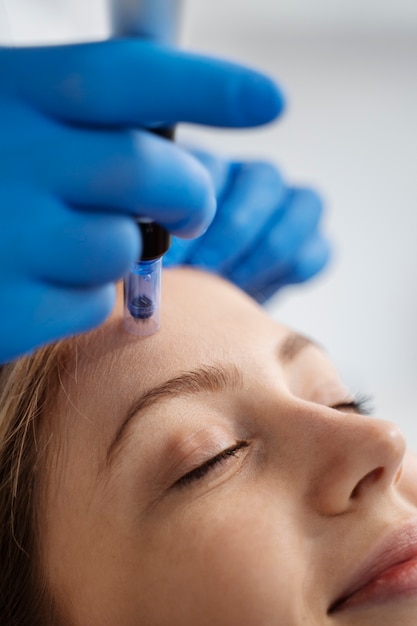 Patient undergoing microneedling procedure