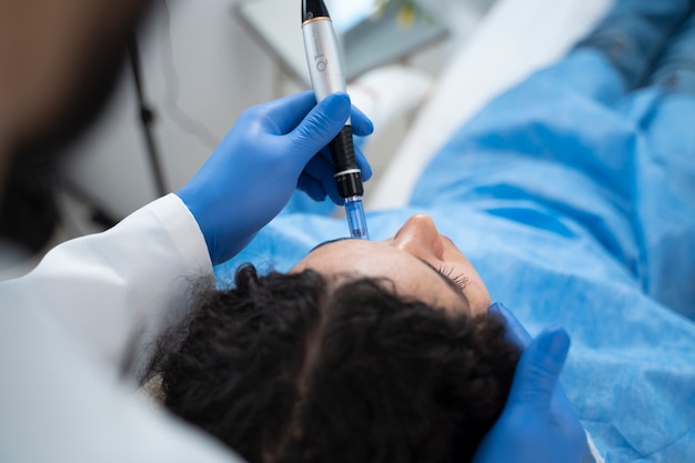 Patient undergoing microneedling procedure