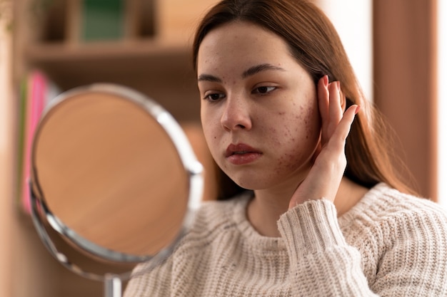 Person dealing with rosacea