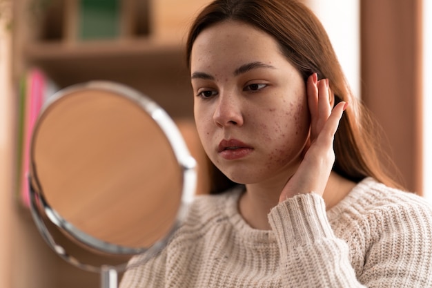 person dealing with rosacea