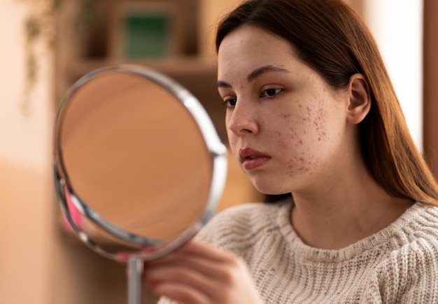 Person dealing with rosacea