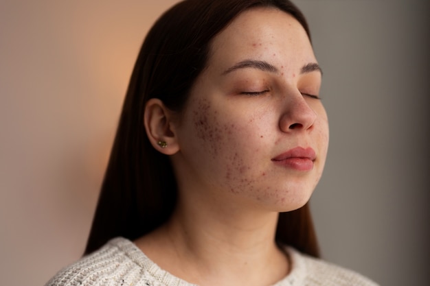 Foto gratuita persona che si occupa di rosacea