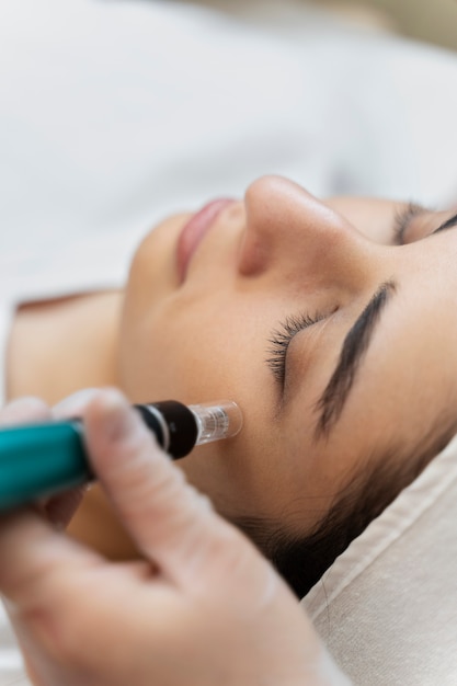 Person getting micro needling beauty treatment