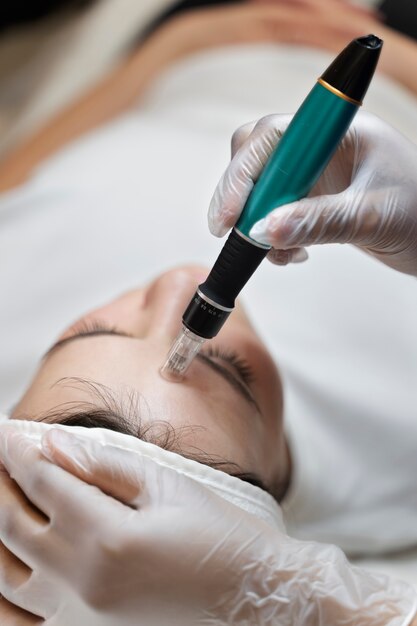 Person getting micro needling beauty treatment