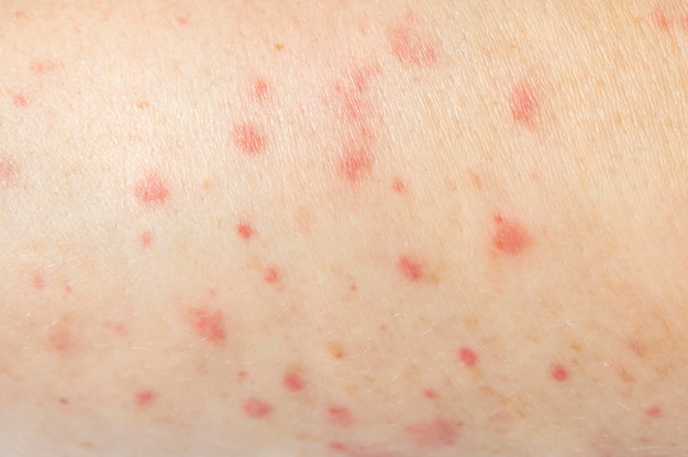 Person having a skin allergy close-up