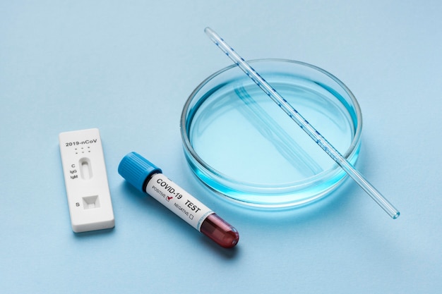 Petri dish and blood sample for covid test