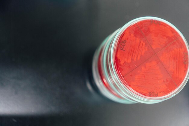Petri dishes loaded with endo red agar and escherichia coli.