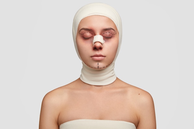 На фото молодая девушка с контурной пластикой, готовится к косметической операции, имеет точечные линии на веках и подбородке, синяки возле глаз, завернута в медицинские повязки.
