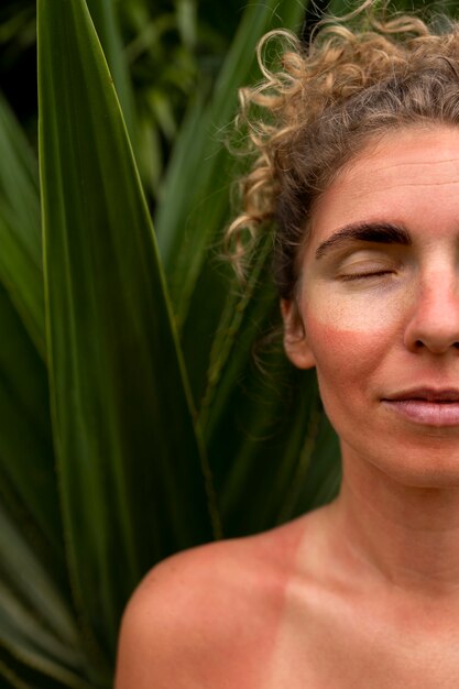 Portrait of adult woman with sunburn skin