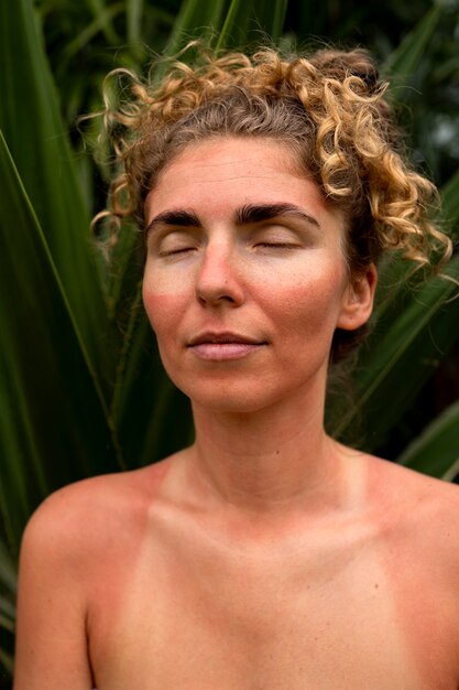 Portrait of adult woman with sunburn skin