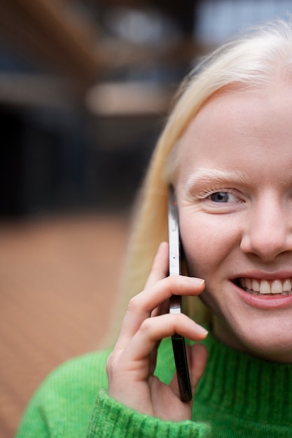 Portrait of albino woman outdoors