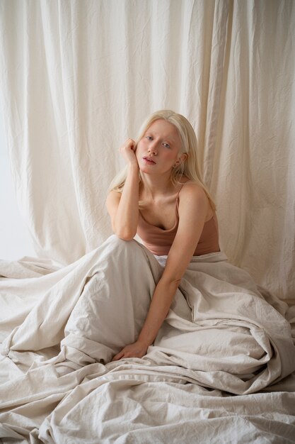 Portrait of beautiful albino woman