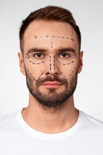 Free photo portrait of man receiving enhancements and tweakments through the help of cosmetic procedures