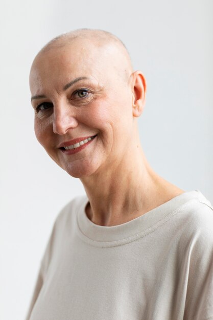 portrait of middle aged woman with skin cancer