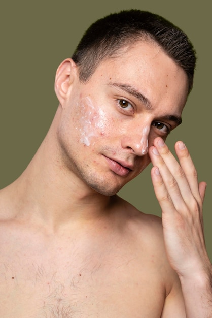 Portrait of young man being confident with acne