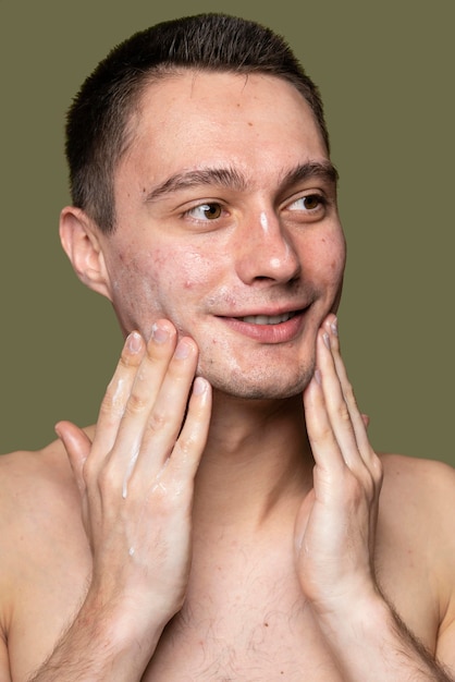 Portrait of young man being confident with acne