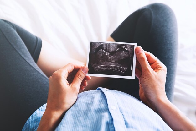 Pregnant woman keeping hand on belly and holding ultrasound image at home interiors