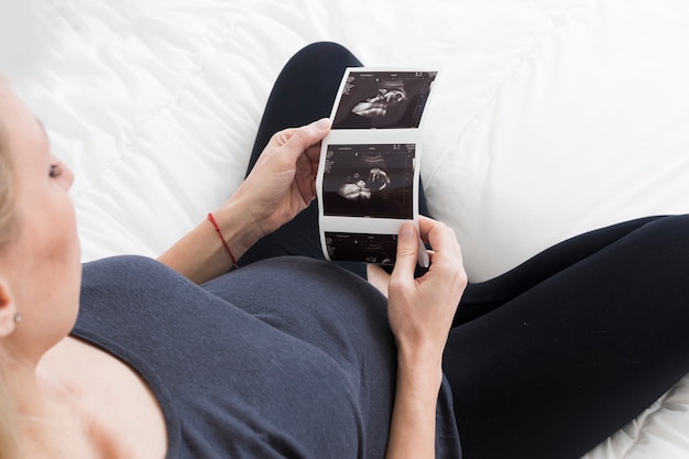 Pregnant woman looking at x ray