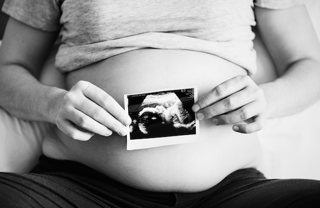 Free photo pregnant woman showing ultrasound photo