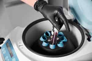 Free photo preparation of blood for injections cosmetologist puts tube of blood in centrifuge