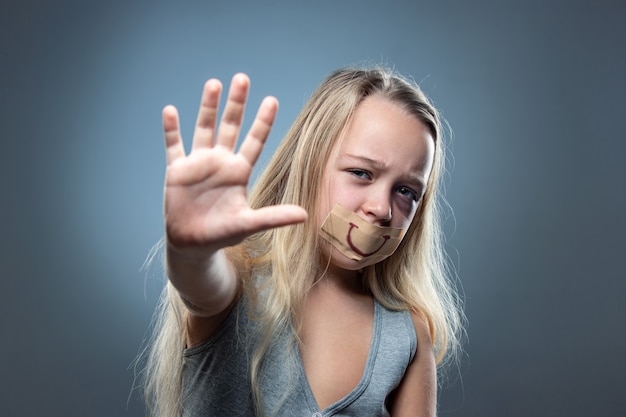 Bambina triste e spaventata con occhi iniettati di sangue, lividi e falso sorriso sulla bocca.