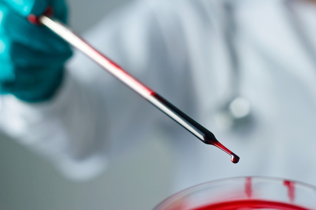 과학 및 의학, 과학자 분석 및 혈액을 유리에 샘플을 떨어 뜨리고, 실험실에서 화학 액체를 포함하는 실험