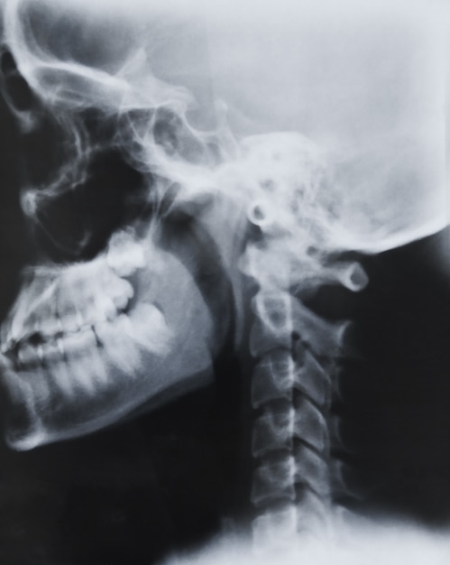 Free photo scientific surgery diagnosis clinical spine