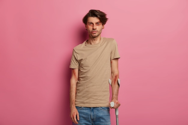 Free photo serious looking bruised man holds crutches, being disabled to walk, recovers after long treatment and serious car accident, has fracture or dislocation of leg. consequences of dangerous riding