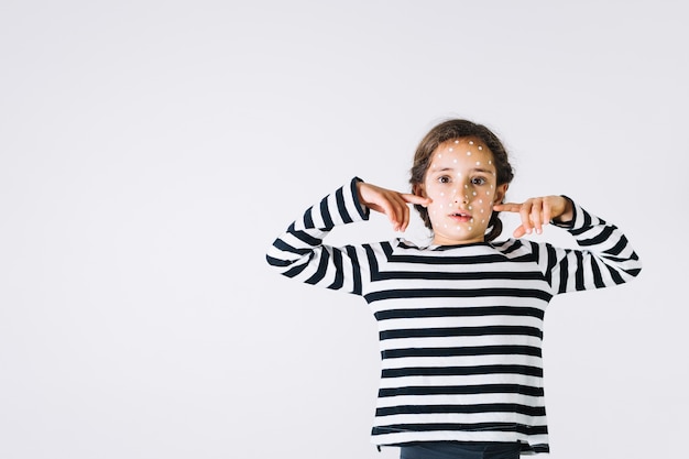 Free photo sick girl pointing at cheeks