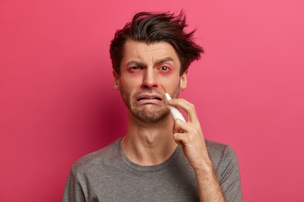 Sick man caught cold, suffers from rhinitis or blocked nose, uses nasal spray, has red swollen eyes, recommends medical treatment, wants to recover quickly, isolated on pink wall. Health care concept