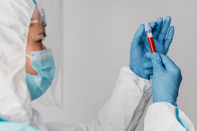 Side view doctor holding a blood sample