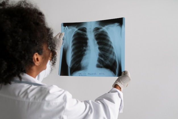 Free photo side view doctor looking at radiography