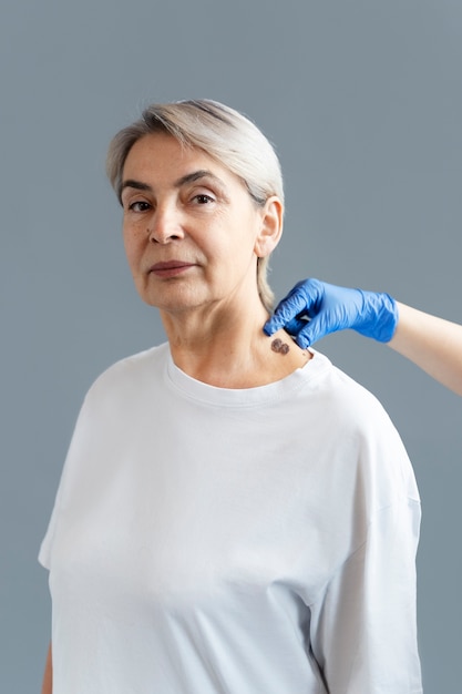 Free photo side view old woman with melanoma