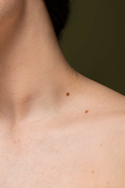 Side view skin texture with moles