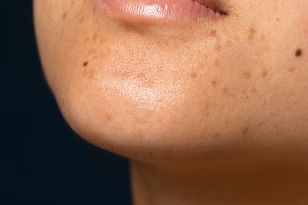 Side view woman skin texture