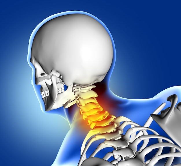 Skeleton with neck pain