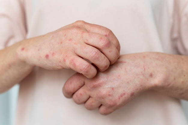 Skin allergy on a person's arm
