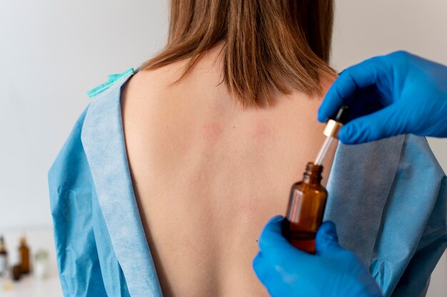 人の背中の皮膚アレルギー反応