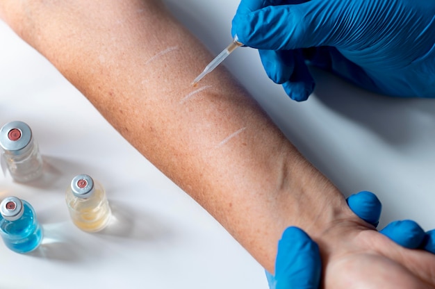 腕の皮膚アレルギー反応試験
