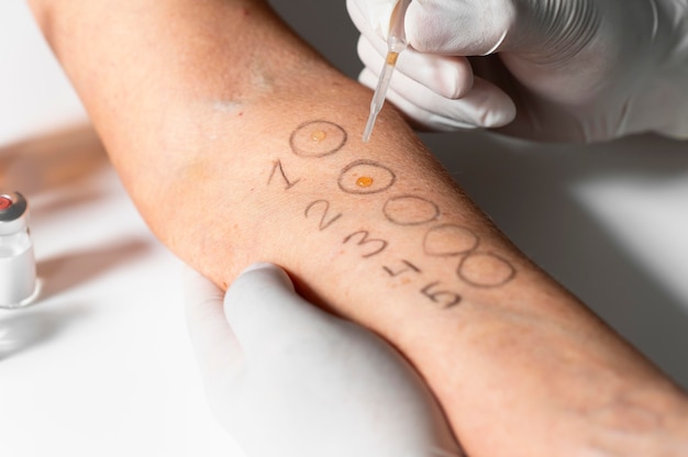 Free photo skin allergy reaction test on arm