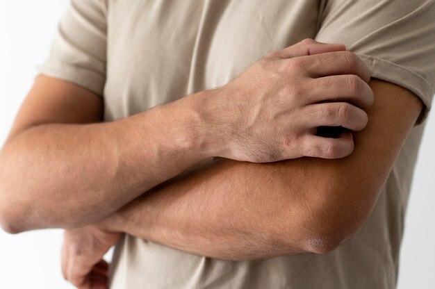Skin allergy reaction test on arm