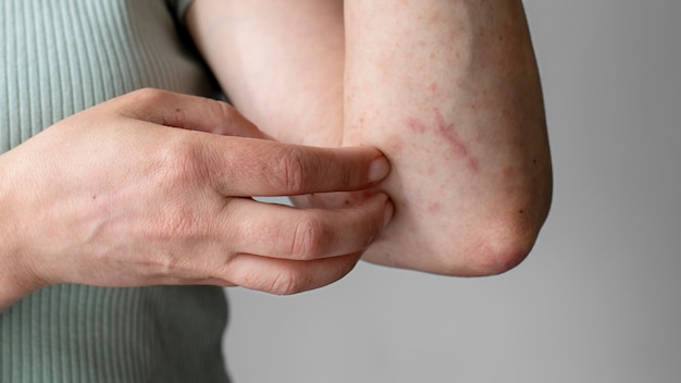 팔에 대한 피부 알레르기 반응 테스트